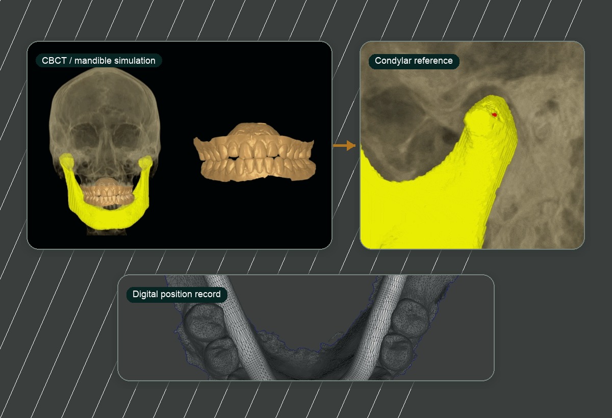 Digital mandibular simulation and condylar reference planning
