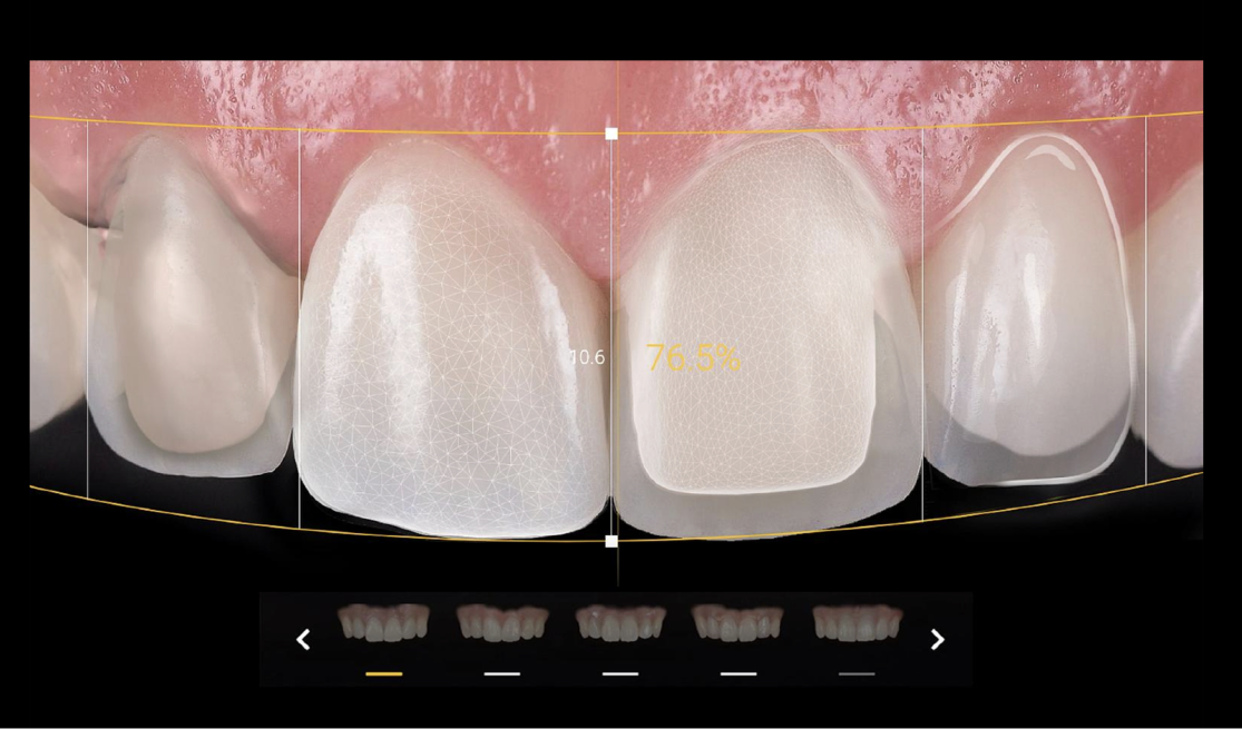 Smile design planning interface for esthetic cases