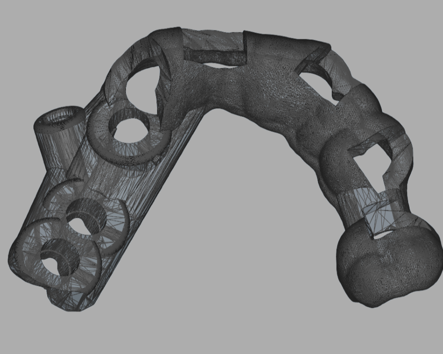 Single implant and partial-arch surgical guide CAD