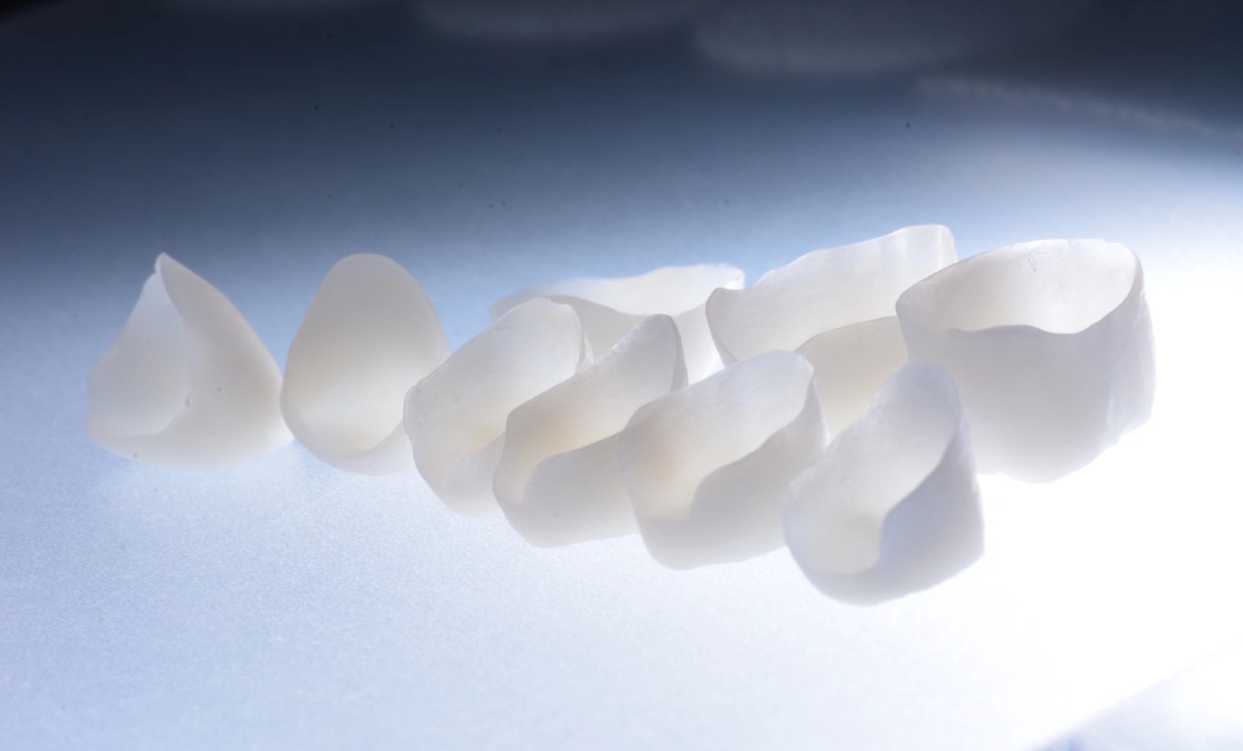 Ceramic restorations arranged for professional review